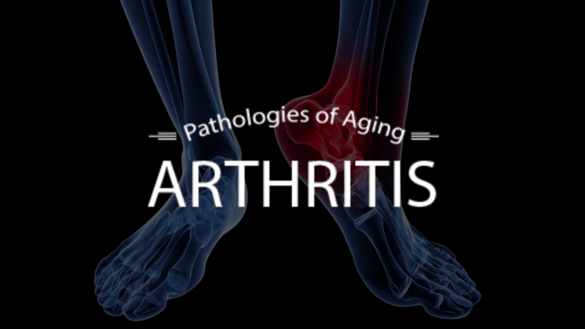 Ayurveda &amp; Anti-Aging - DVD Set Experience Ayurveda 